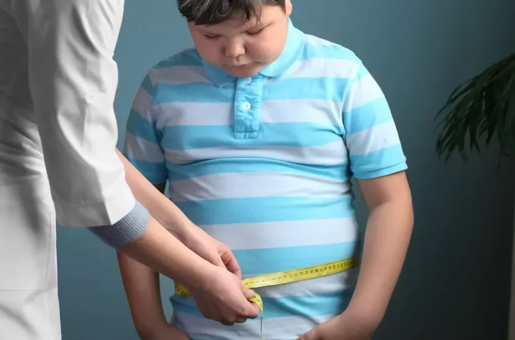 Obesitas pada Anak