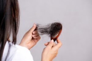 Rambut Rontok: Penyebab, Pencegahan, dan Solusi Terbaik Rambut Rontok